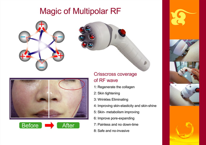 A-08 Collagen Fullness